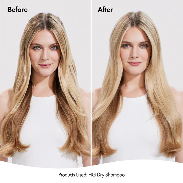 Bondi Boost Hair Growth Dry Shampoo