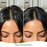 Bondi Boost Hair Growth Dry Shampoo