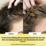 Bondi Boost Hair Growth Lock Drops Anti-Shedding Scalp and Hair Serum