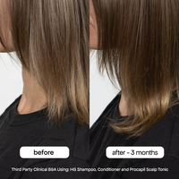 Bondi Boost Hair Growth Duo 300ml