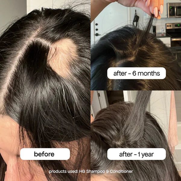 Bondi Boost Hair Growth Elixir Trio